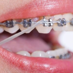 Orthodontics